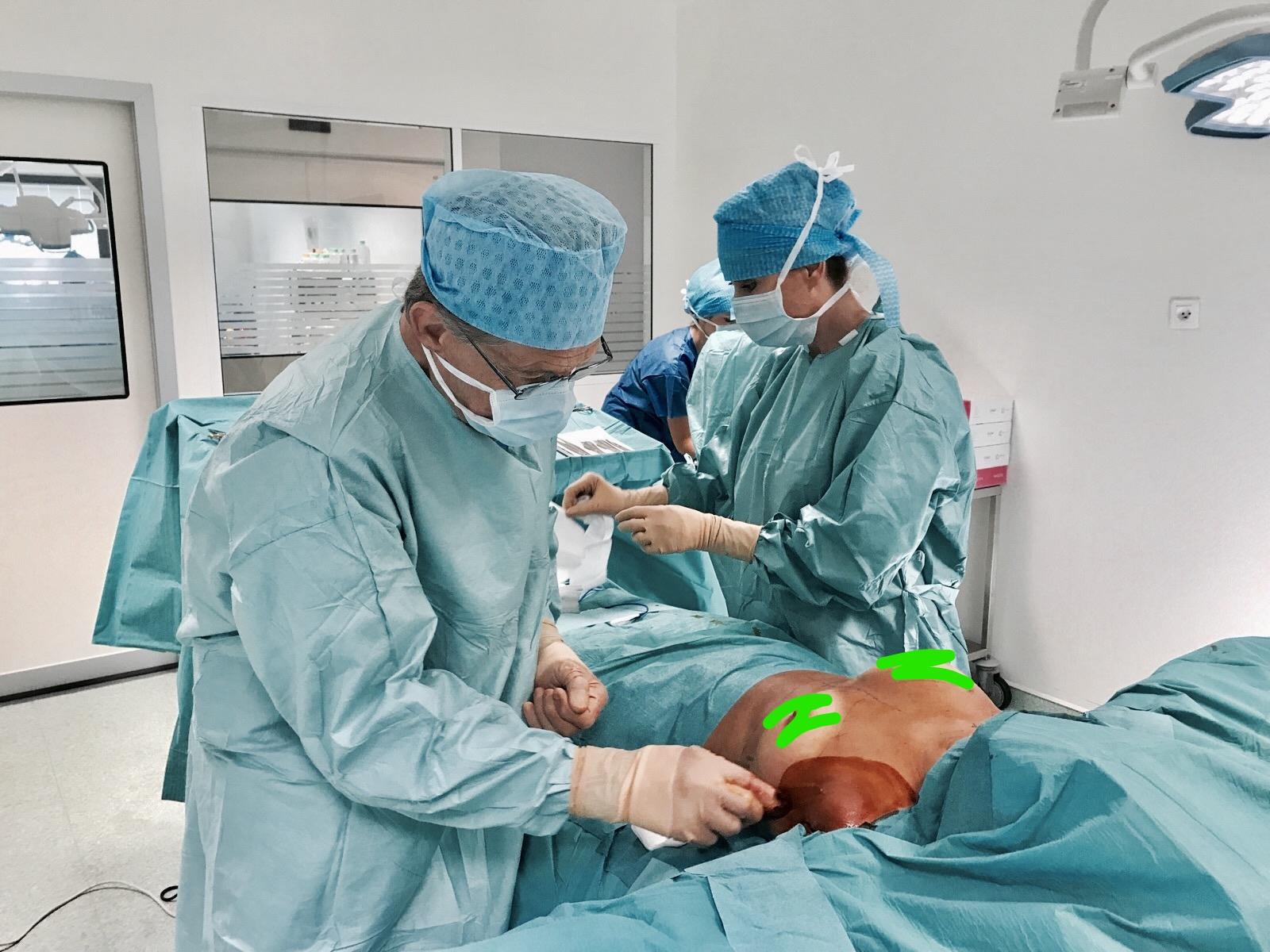 Résultats d'opérations de chirurgie plastique