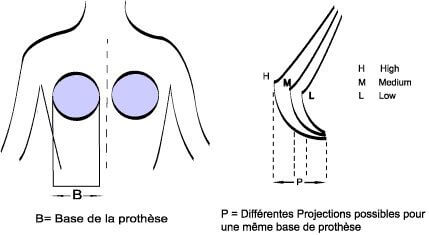 prothèse mammaire à base circulaire